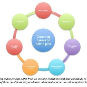 Causes of Pelvic Pain